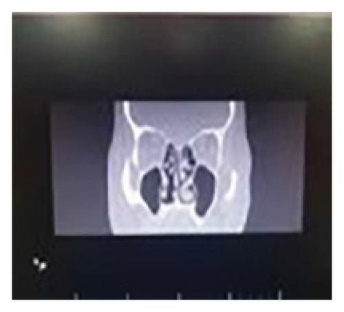 Details are in the caption following the image