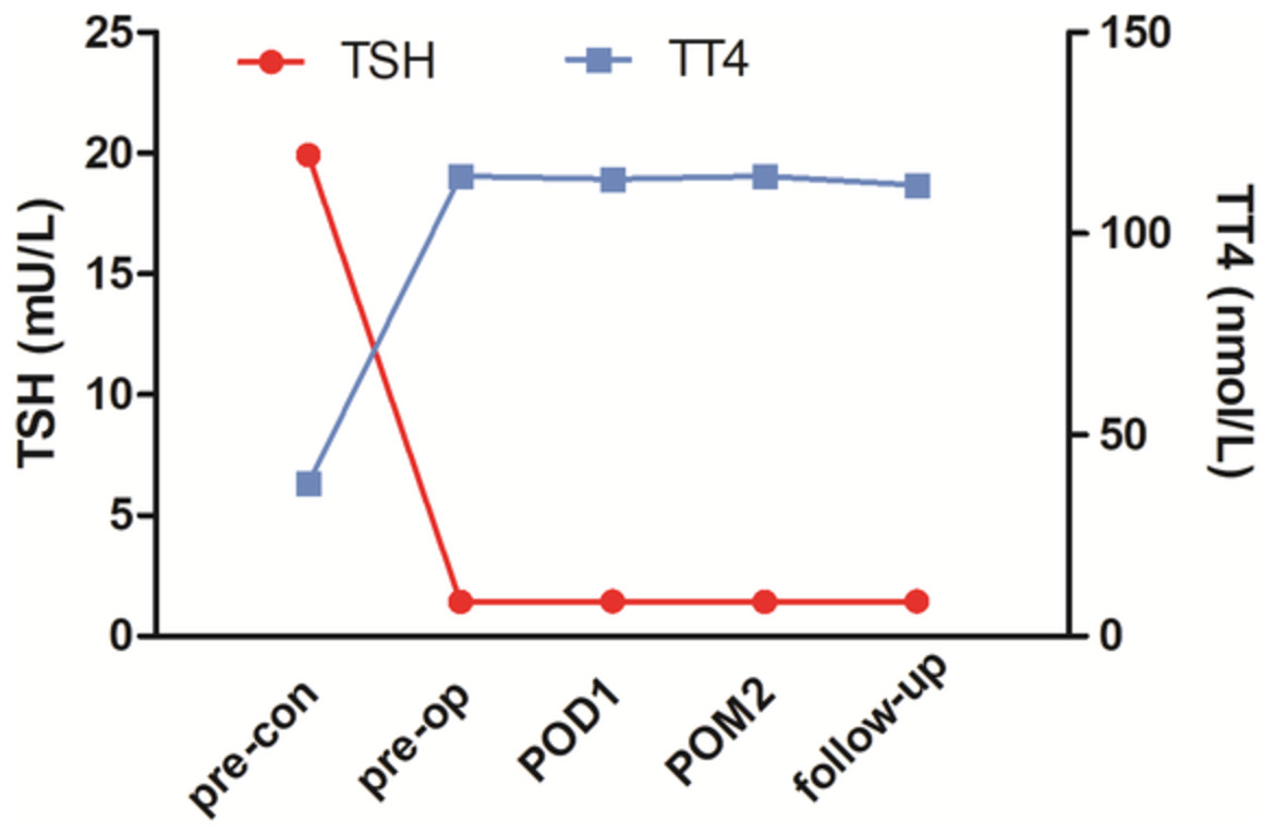 Does well-controlled overt hypothyroidism increase the risk of total knee arthroplasty?