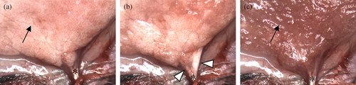 Details are in the caption following the image