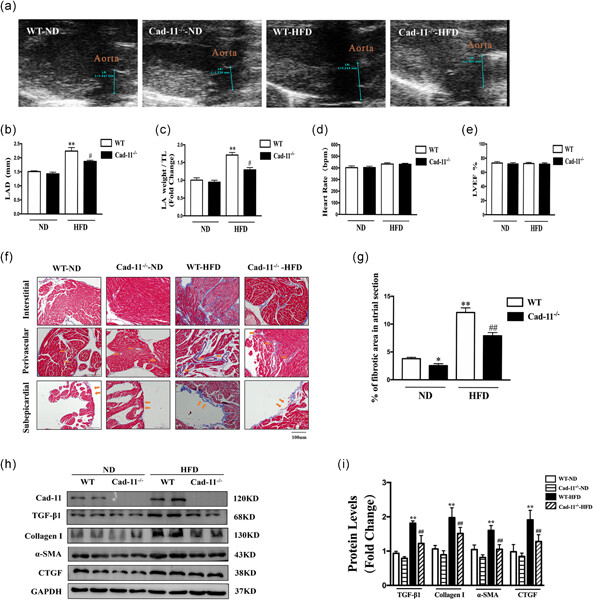 Cadherin-11 deficiency mitigates high-fat diet-induced inflammatory atrial remodeling and vulnerability to atrial fibrillation