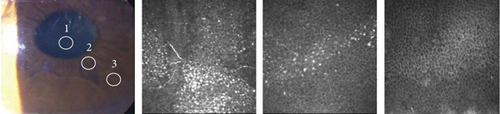 Details are in the caption following the image