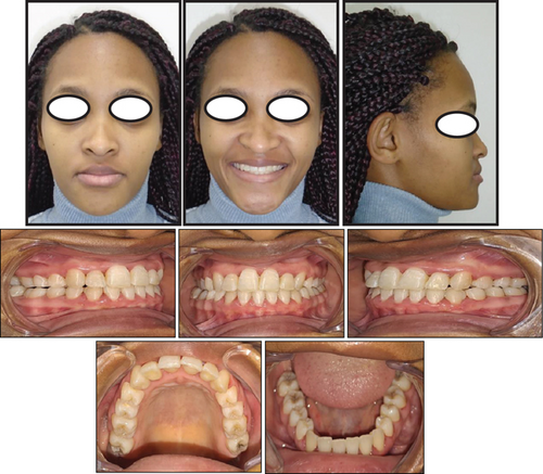 Details are in the caption following the image Details are in the caption following the image