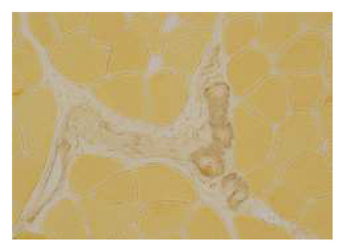 Details are in the caption following the image