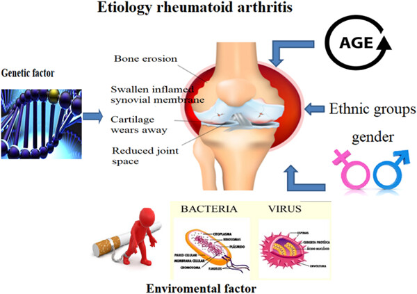 Genetics and rheumatoid arthritis susceptibility in Iran