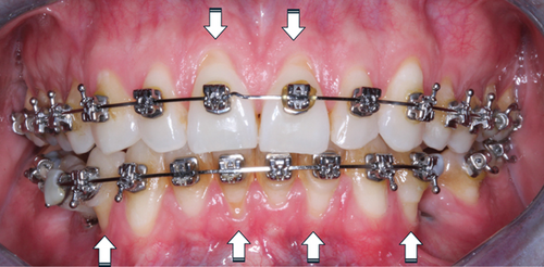 Details are in the caption following the image Details are in the caption following the image