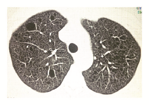 Details are in the caption following the image