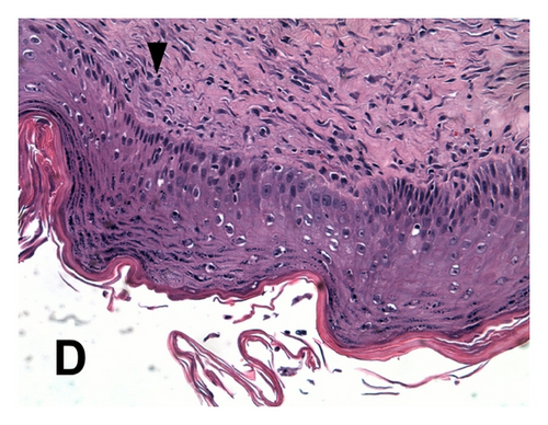 Details are in the caption following the image
