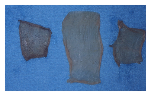 Details are in the caption following the image