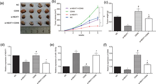 Retracted: Long noncoding RNA nuclear enriched abundant transcript 1 impacts cell proliferation, invasion, and migration of glioma through regulating miR-139-5p/
CDK6