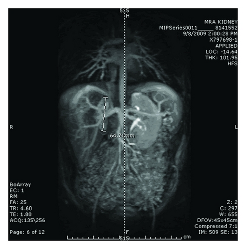 Details are in the caption following the image