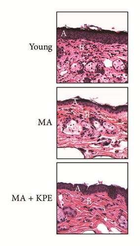 Details are in the caption following the image