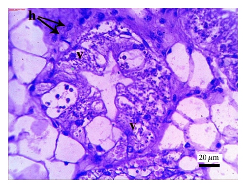 Details are in the caption following the image
