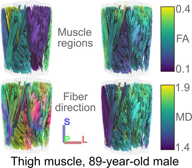 Age-related changes in human skeletal muscle microstructure and architecture assessed by diffusion-tensor magnetic resonance imaging and their association with muscle strength