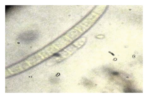 Details are in the caption following the image