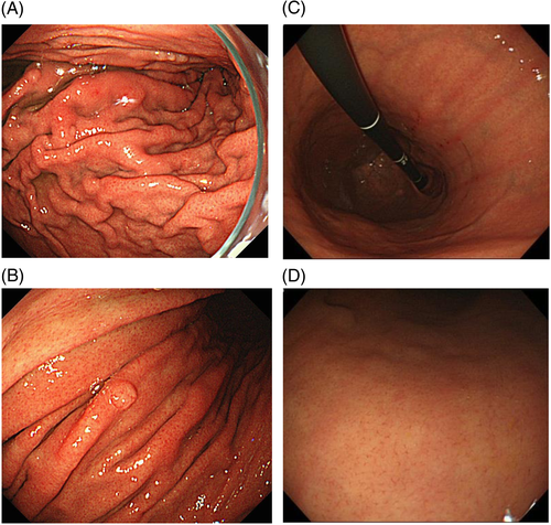 Details are in the caption following the image Details are in the caption following the image