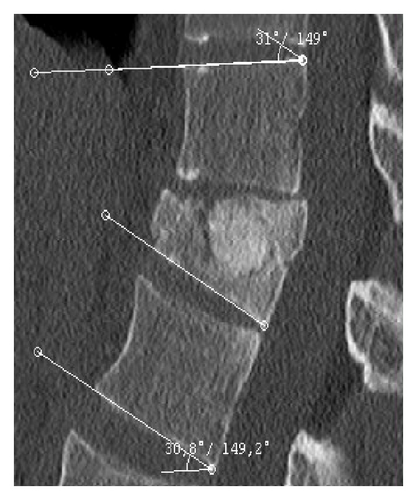 Details are in the caption following the image