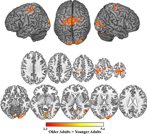 Neural evidence for phonologically based language production deficits in older adults: An fMRI investigation of age-related differences in picture-word interference