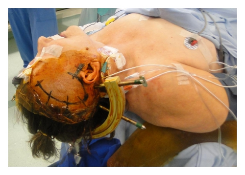 Details are in the caption following the image Details are in the caption following the image