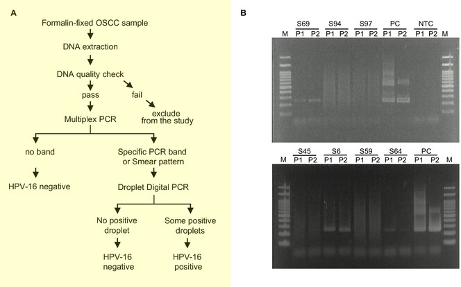 Robust HPV-16 Detection Workflow for Formalin-Fixed Cancer Tissue and Its Application for Oral Squamous Cell Carcinoma