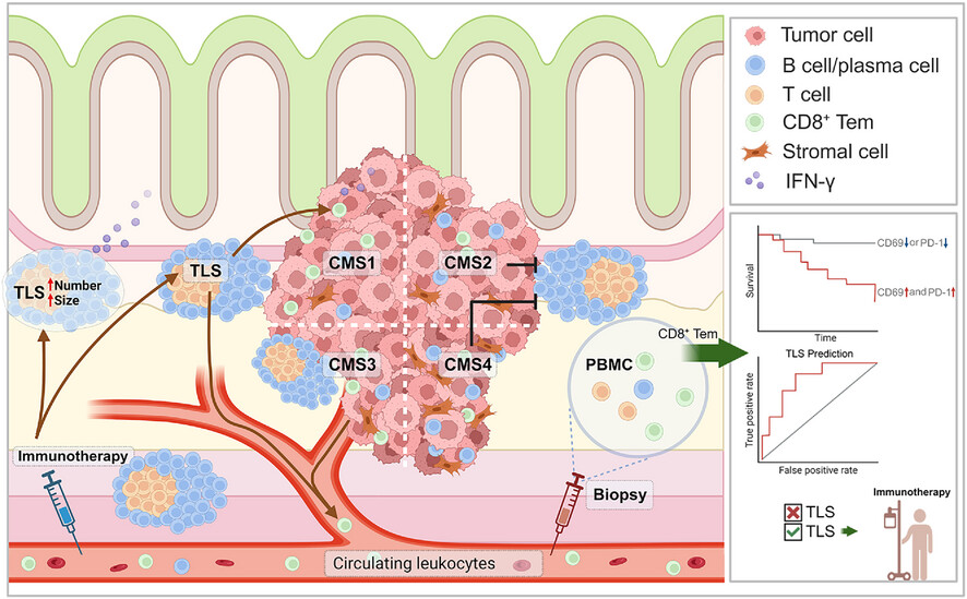 Immune profiling of the macroenvironment in colorectal cancer unveils systemic dysfunction and plasticity of immune cells