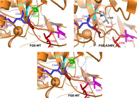 A homozygous missense variant of SUMF1 in the Bedouin population extends the clinical spectrum in ultrarare neonatal multiple sulfatase deficiency
