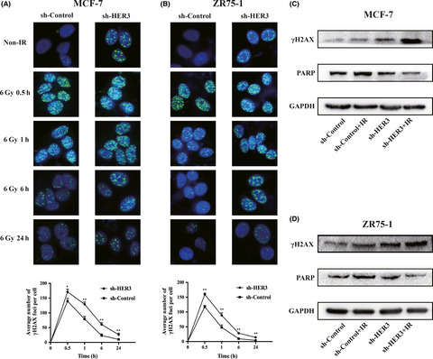 Silencing human epidermal growth factor receptor-3 radiosensitizes human luminal A breast cancer cells
