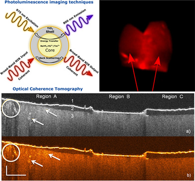 TiO2-coated fluoride nanoparticles for dental multimodal optical imaging