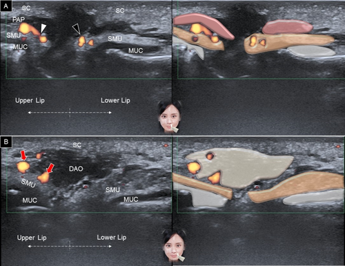 Details are in the caption following the image Details are in the caption following the image