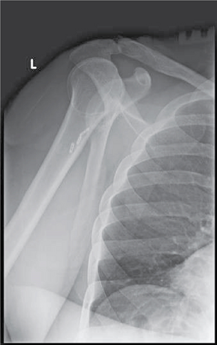 Details are in the caption following the image