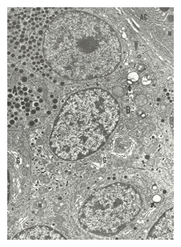 Details are in the caption following the image