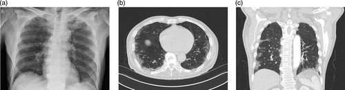 Details are in the caption following the image Details are in the caption following the image