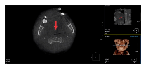 Details are in the caption following the image Details are in the caption following the image