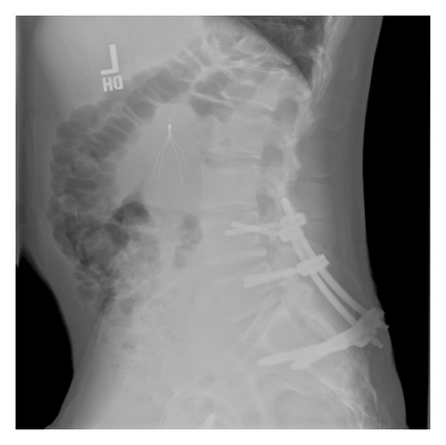 Details are in the caption following the image
