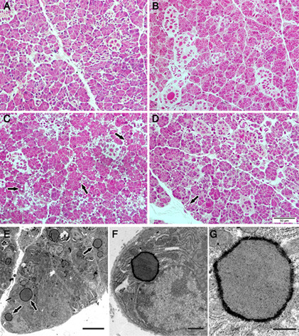 Low-power laser irradiation decreases lipid droplet accumulation in the parotid glands of diabetic rats