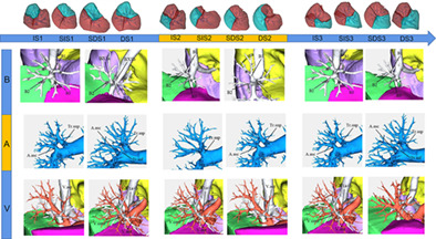 The regularity of anatomical variations of dominant pulmonary segments in the right upper lobe