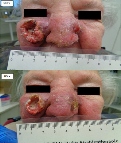 Details are in the caption following the image Details are in the caption following the image