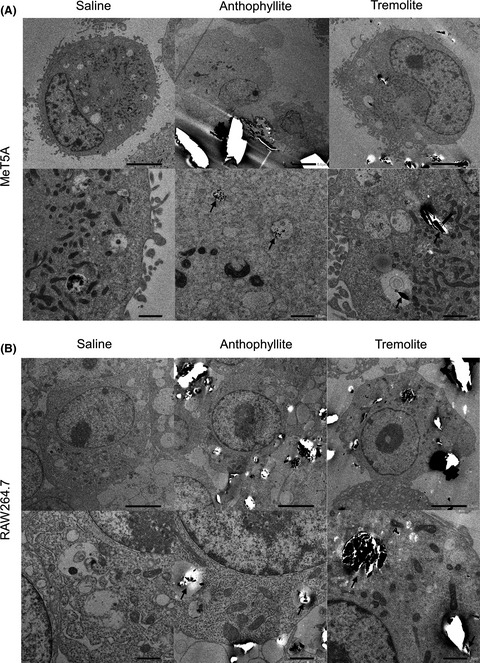 Frequent homozygous deletion of Cdkn2a/2b in tremolite-induced malignant mesothelioma in rats