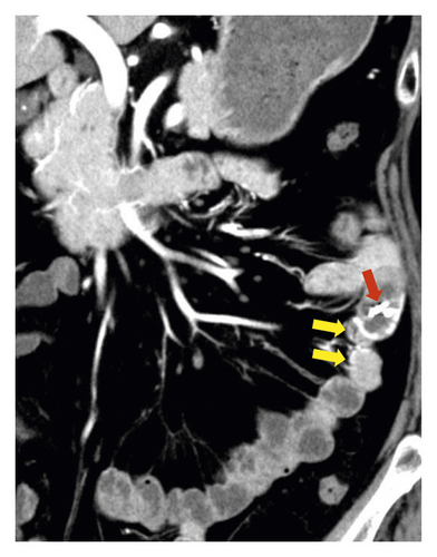 Details are in the caption following the image