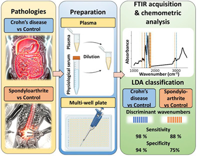 Identification of circulating biomarkers of Crohn's disease and spondyloarthritis using Fourier transform infrared spectroscopy
