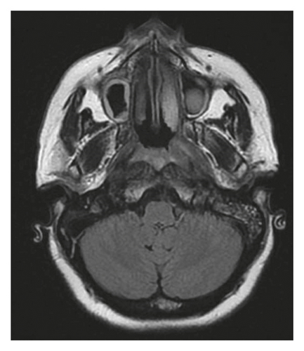 Details are in the caption following the image