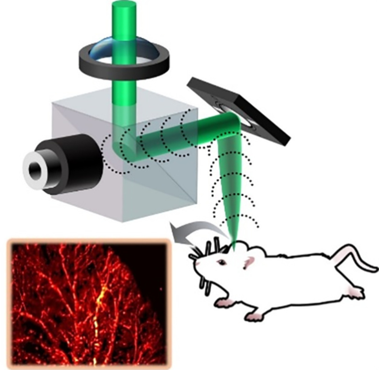 Acoustic resolution photoacoustic microscopy based on microelectromechanical systems scanner