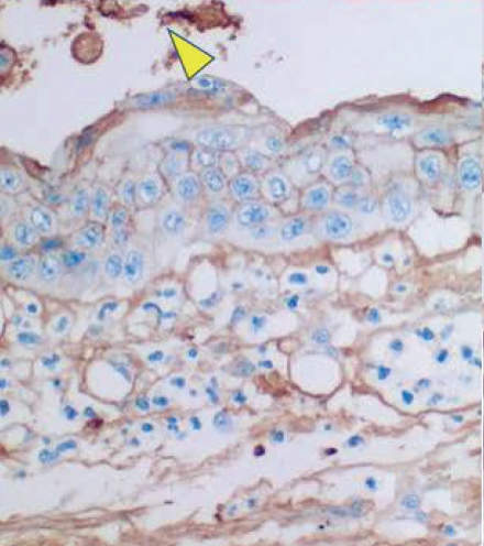 Details are in the caption following the image