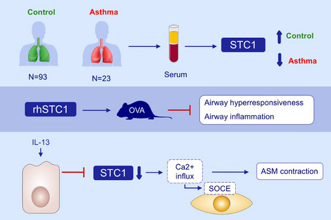Epithelial expression and role of secreted STC1 on asthma airway hyperresponsiveness through calcium channel modulation