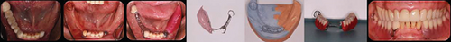 Details are in the caption following the image