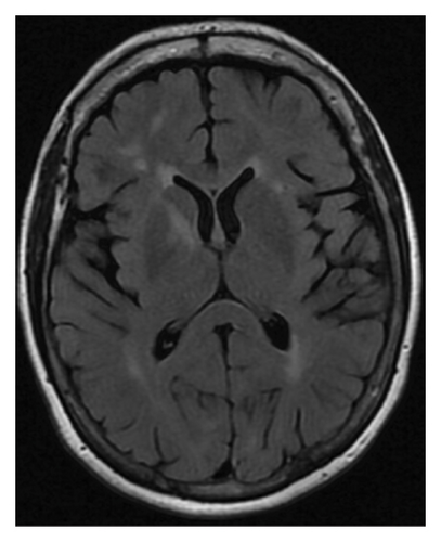 Details are in the caption following the image