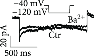 Details are in the caption following the image