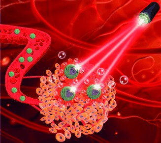 Near-Infrared-Activated Nanocalorifiers in Microcapsules: Vapor Bubble Generation for In Vivo Enhanced Cancer Therapy