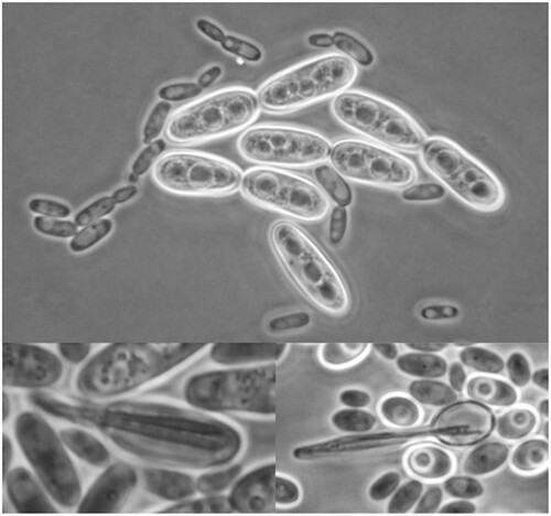 Metschnikowia: half tetrads, a regicide and the fountain of youth