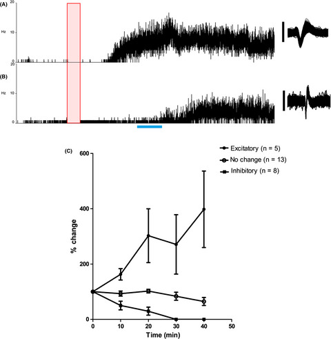 The projection of anorectal afferents to spinal cord and effect of sacral neuromodulation on dorsal horn neurons which receive such input in the rat