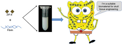Enhanced Bone Regeneration Using a ZIF-8-Loaded Fibrin Composite Scaffold